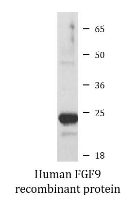 Human FGF9 recombinant protein (Active)