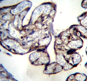 Anti-BNIP2