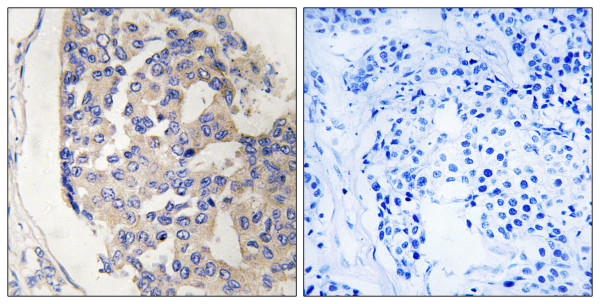 Anti-Component C1s