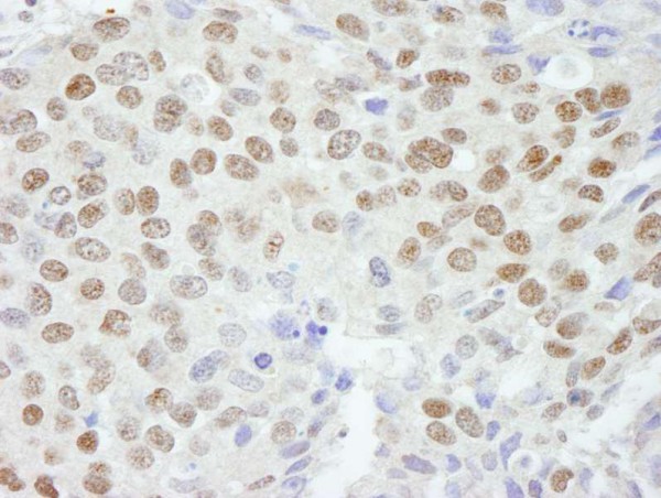 Anti-ZNF295 (IHC)