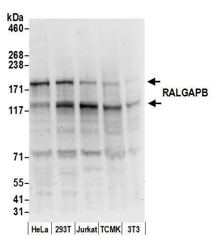 Anti-RALGAPB