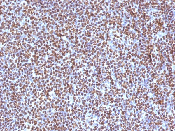 Anti-ALK (Anaplastic Lymphoma Kinase) / CD246, clone ALK/1504