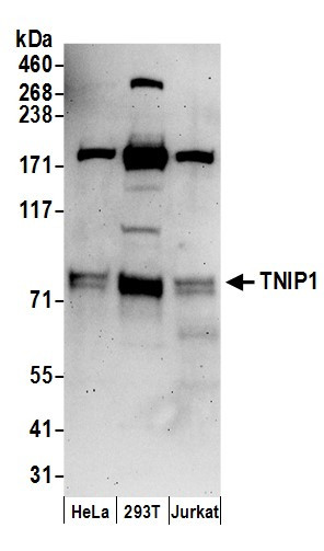 Anti-TNIP1