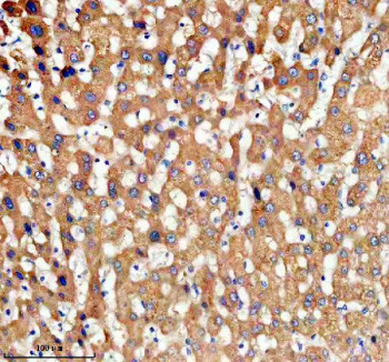 Anti-TDO2 / Tryptophan 2,3-dioxygenase