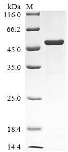 Serine/threonine-protein kinase LATS1 (LATS1), partial, human, recombinant