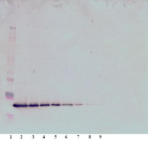 Anti-Thrombopoietin (Tpo)