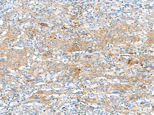 Anti-HLA-DRB3