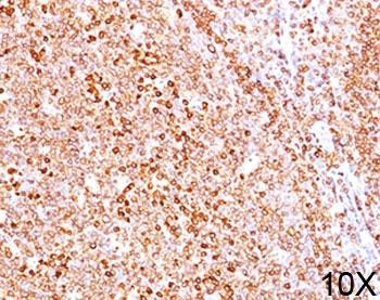 Anti-CD79a, clone HM47/A9