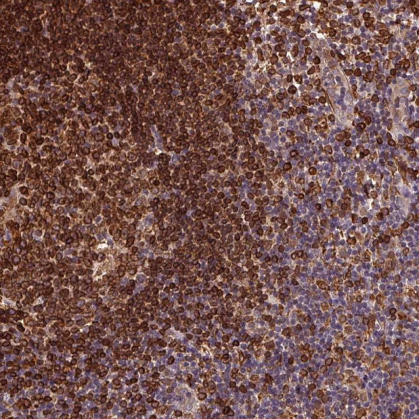 Anti-RNASET2