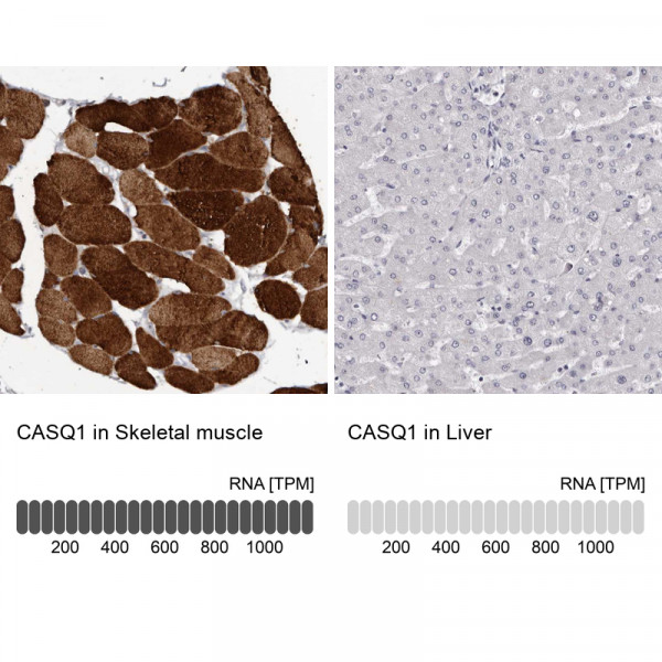 Anti-CASQ1