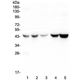 Anti-Alpha 1 microglobulin / AMBP