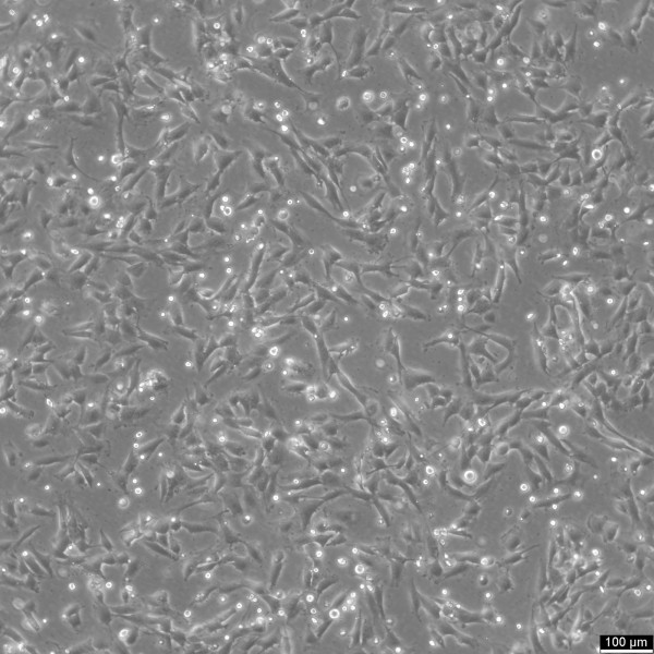 SW-579 Cells