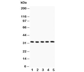 Anti-HSD11B1