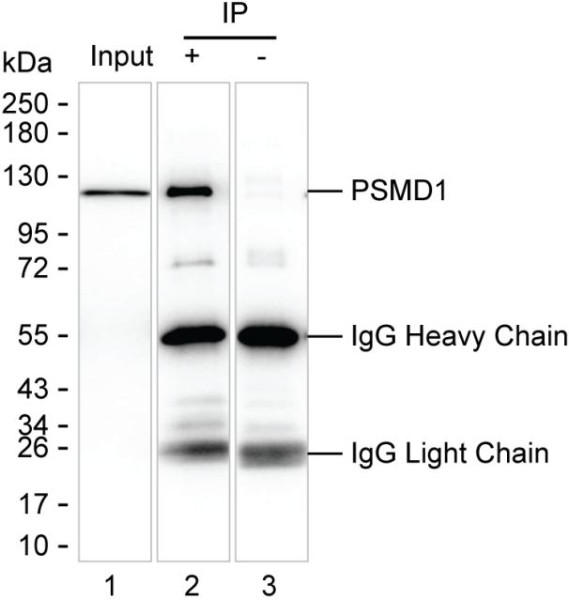 Anti-PSMD1