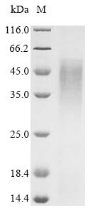 BCL2/adenovirus E1B 19 kDa protein-interacting protein 3 (Bnip3), mouse, recombinant