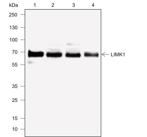 Anti-Recombinant LIMK1, clone A762