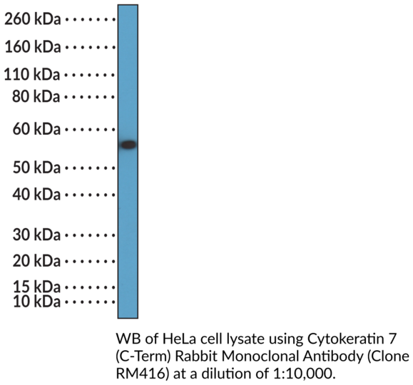 Anti-Cytokeratin 7 (C-Term) Rabbit Monoclonal Antibody (Clone RM416)