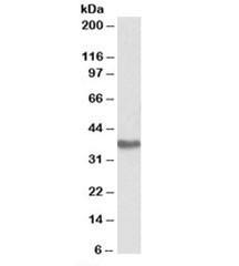 Anti-GNA12Antibody