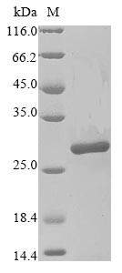 Poly [ADP-ribose] polymerase 14 (PARP14), partial, human, recombinant