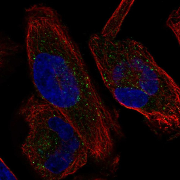 Anti-KCNH1