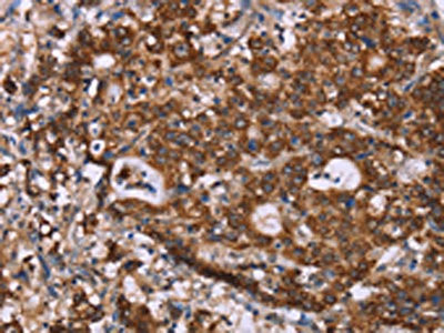 Anti-GAD1