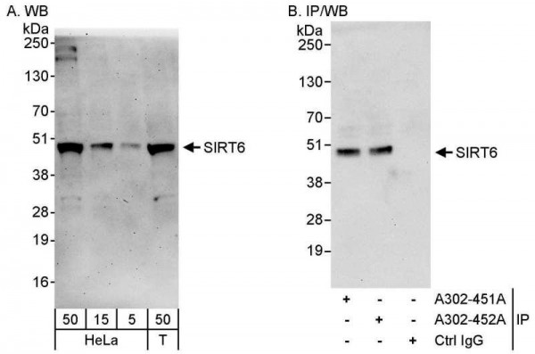 Anti-Sirt6