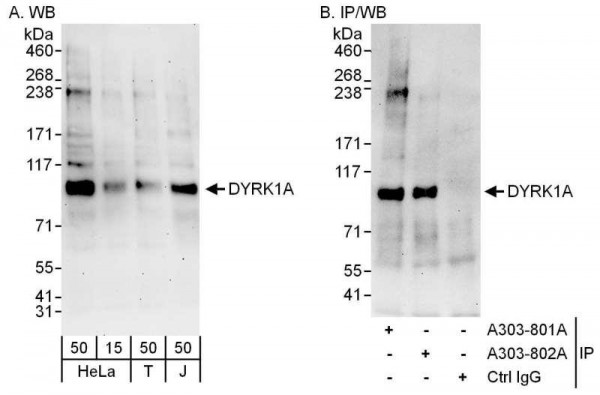 Anti-DYRK1A