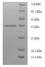 Tumor protein D52 (TPD52), human, recombinant