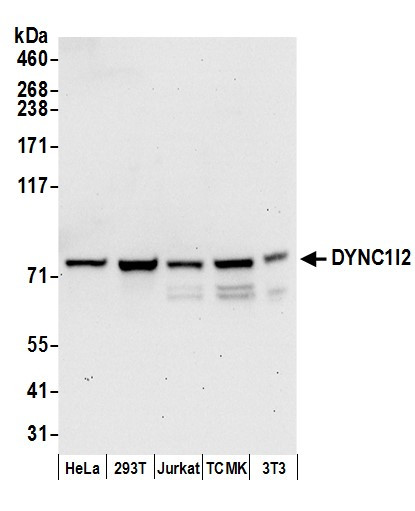 Anti-DYNC1I2