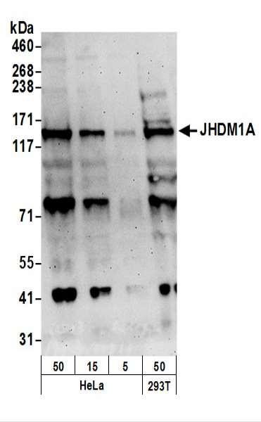 Anti-JHDM1A