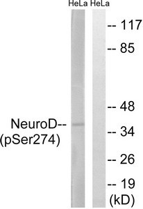 Anti-Phospho-NEUROD1 (Ser274)