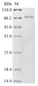 RNA-binding protein MEX3A (MEX3A), human, recombinant