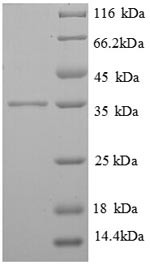 High affinity immunoglobulin epsilon receptor subunit gamma (FCER1G), human, recombinant