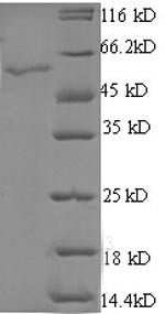 StAR-related lipid transfer protein 7, mitochondrial (STARD7),partial, human, recombinant