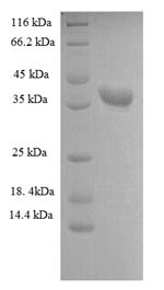Heterogeneous nuclear ribonucleoprotein A1 (HNRNPA1), partial, human, recombinant