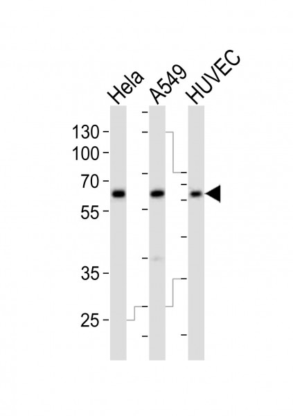 Anti-Estrogen-related receptor gamma