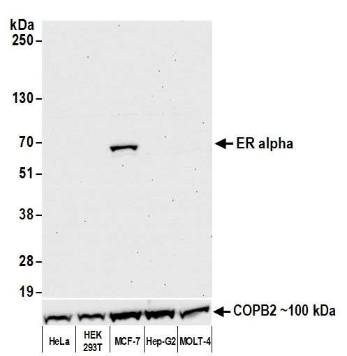 Anti-Estrogen Receptor Alpha Monoclonal