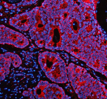 Anti-PEX1 / Peroxisome biogenesis factor 1