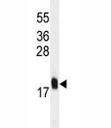Anti-MCFD2, clone 165CT13.1.6