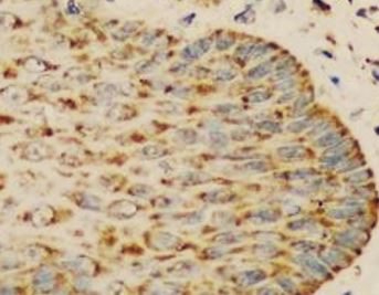 Anti-IGF2BP3