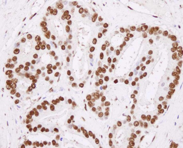 Anti-hnRNP-H (IHC)