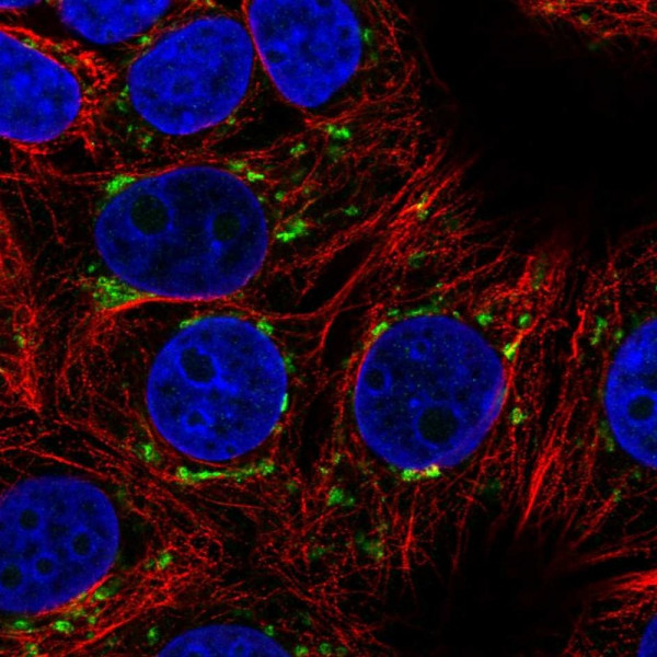 Anti-ARFIP1