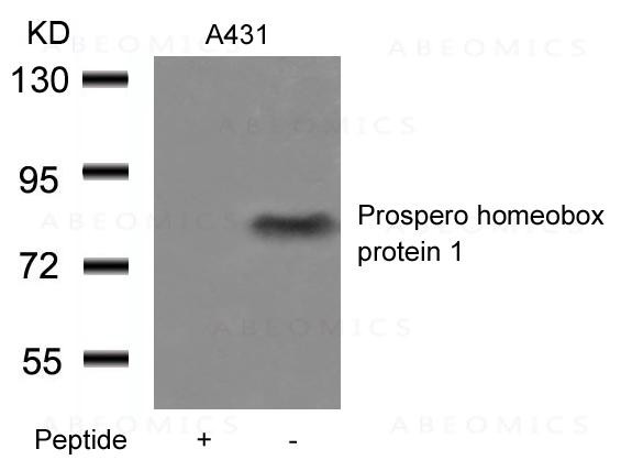 Anti-Prospero homeobox protein 1