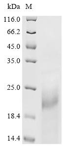 Cyclin-dependent kinase inhibitor 1 (Cdkn1a), recombinant mouse