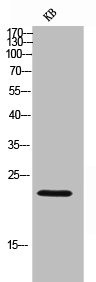 Anti-IGLL1