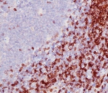 Anti-CD5, clone SPM546