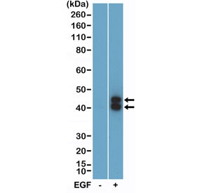 Anti-phospho-ERK1/2 (pThr202/pTyr204), clone RM451