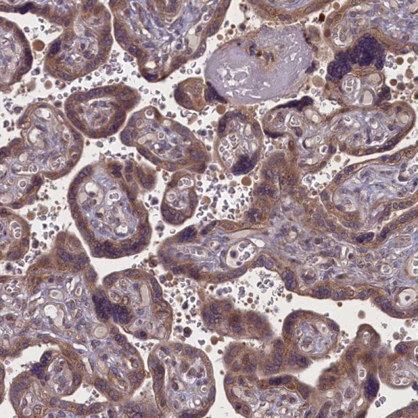 Anti-MYCBP