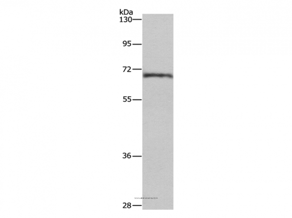 Anti-CDK5RAP3