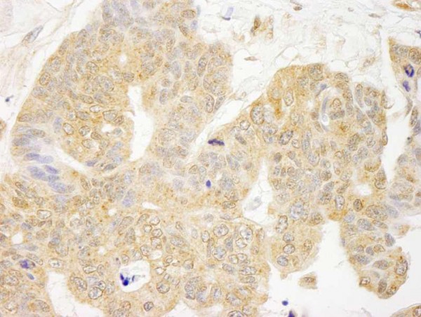 Anti-GRB10 (IHC)